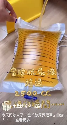 門診來了一位「憋尿界冠軍」的病人！