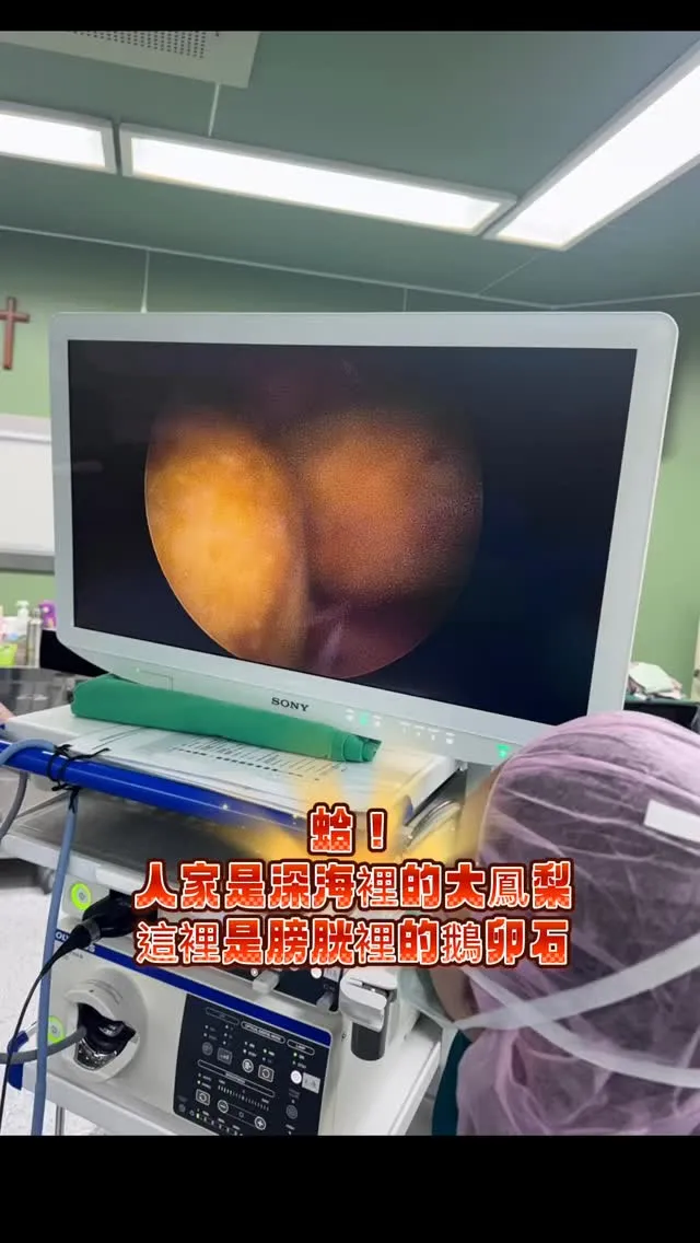 115年度最大顆鵝卵石