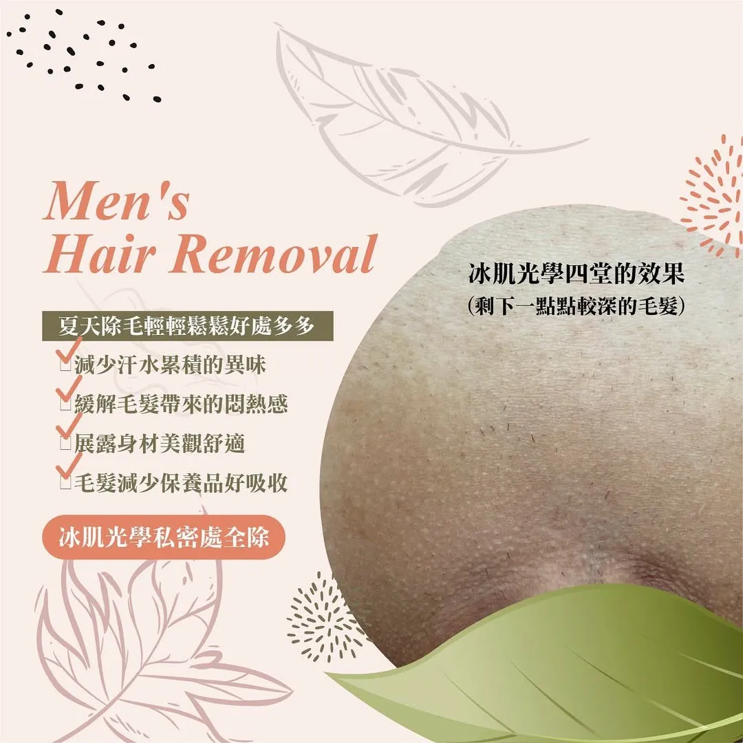 日式光學除毛  循序漸進改善毛髮量，依個人體質做到一定次數可達「半永久性除毛」。