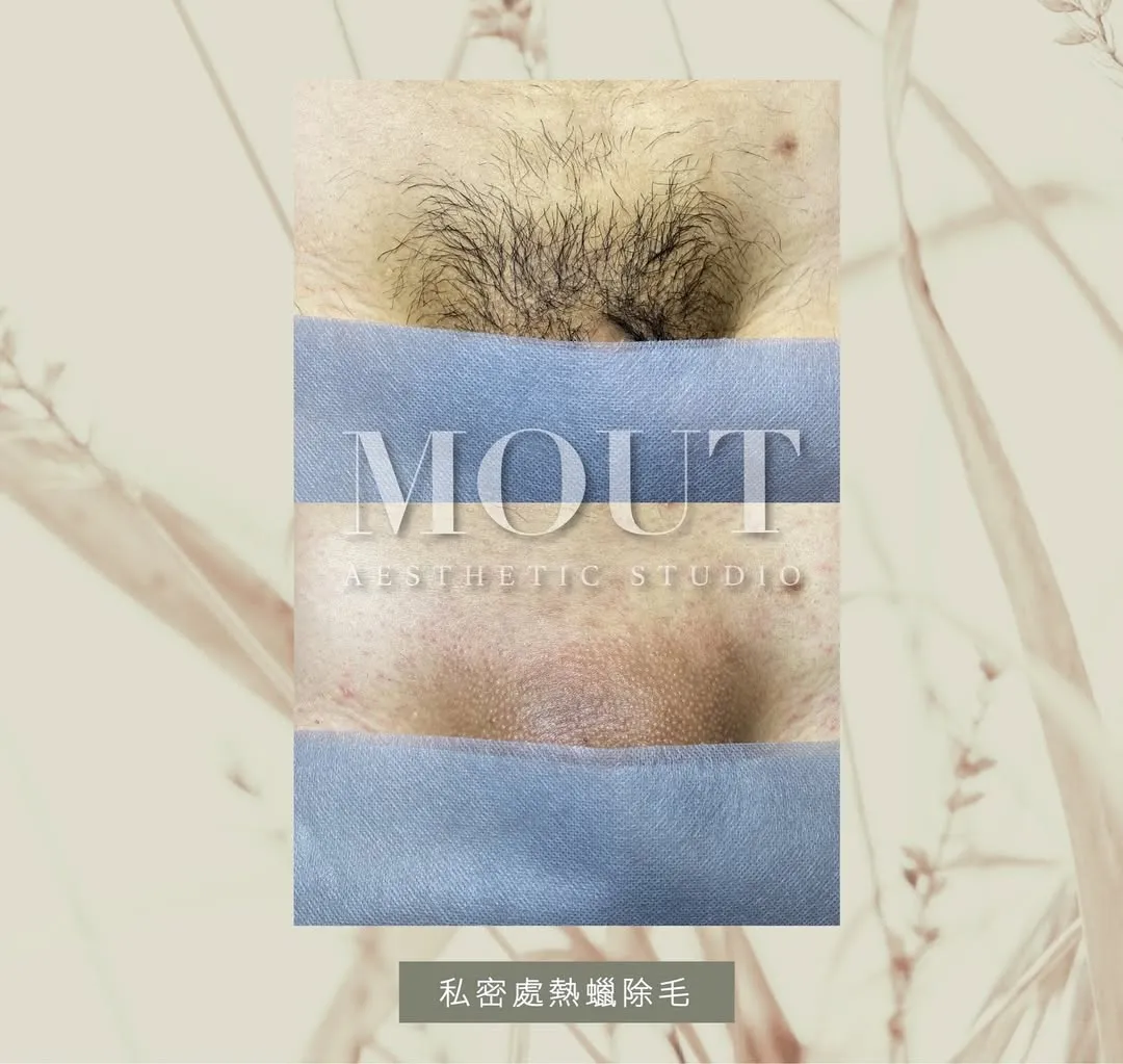 不論是夏天或冬天 男性的『小弟弟』因長年包裹在包皮裡頭