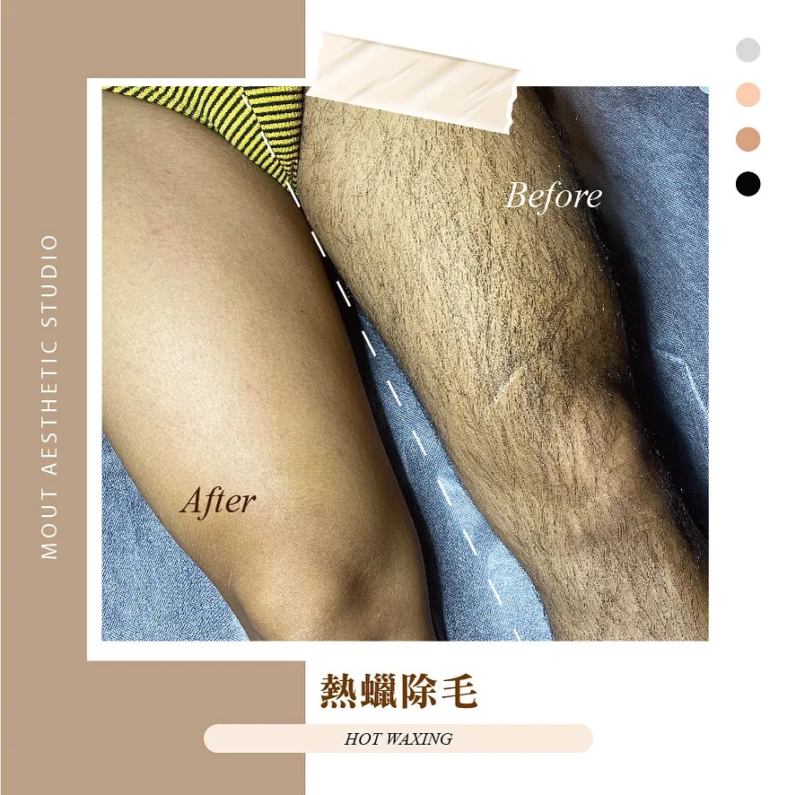 男生不用除腿毛嗎