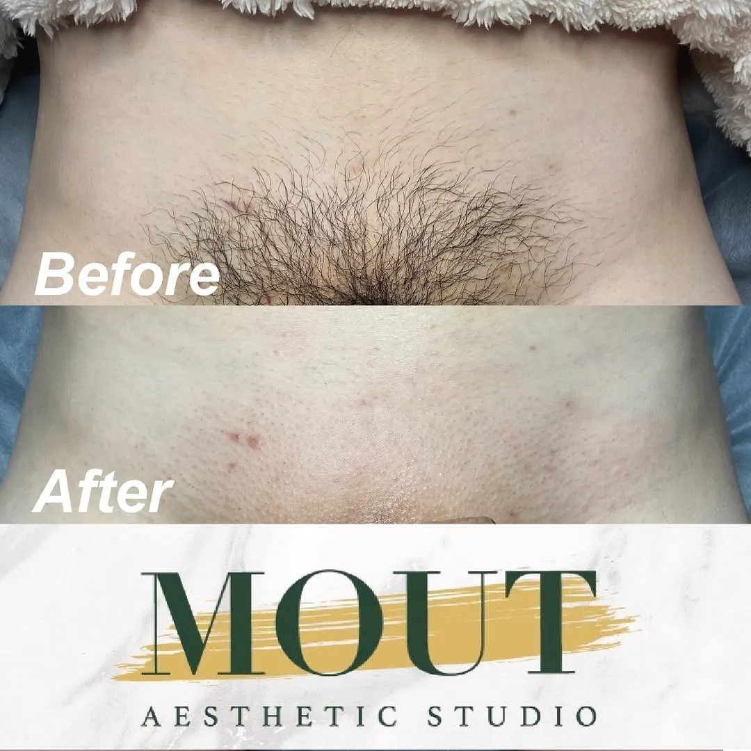 不論是夏天或冬天 男性的『小弟弟』因長年包裹在包皮裡頭