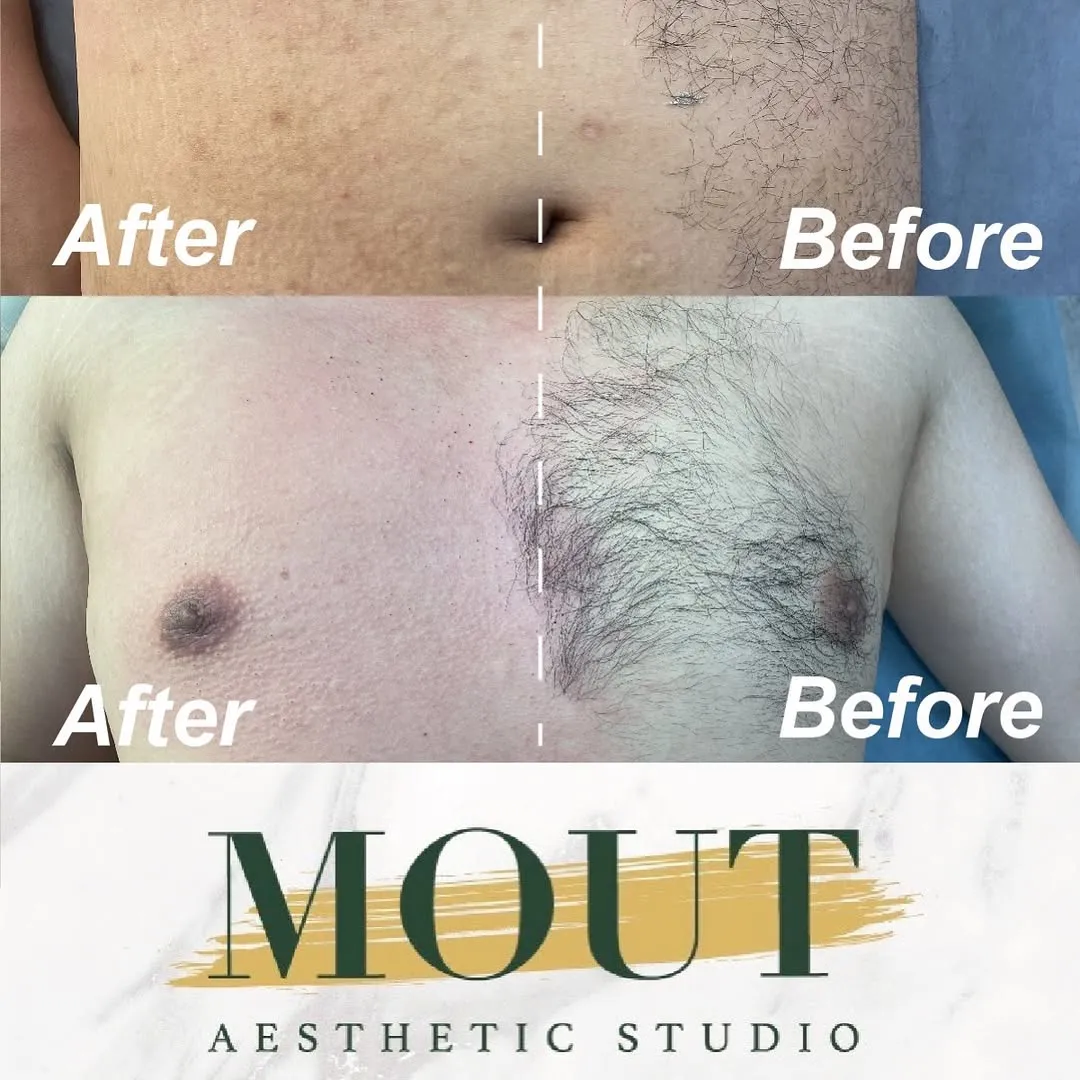 胸部、腹部的毛髮也可以整理喔