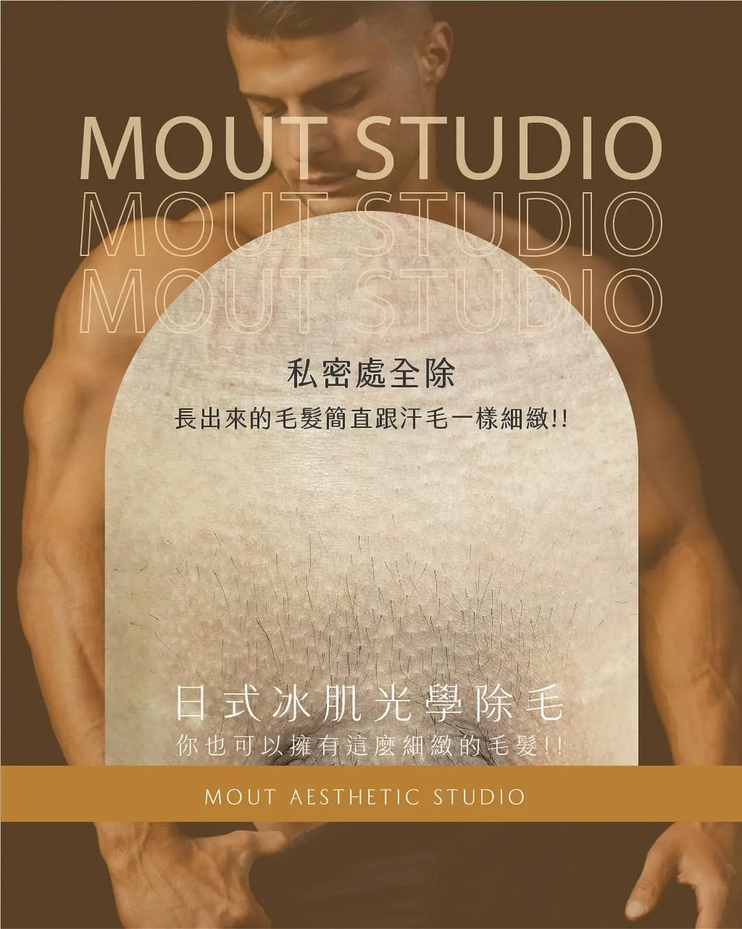 日式光學冰肌除毛｜誰最適合？