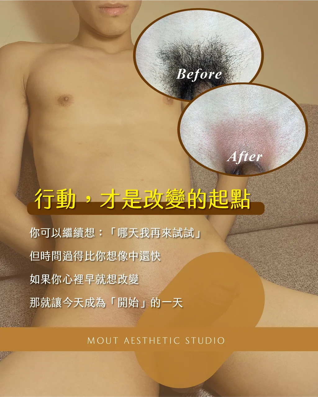 為什麼越來越多男生開始除毛？