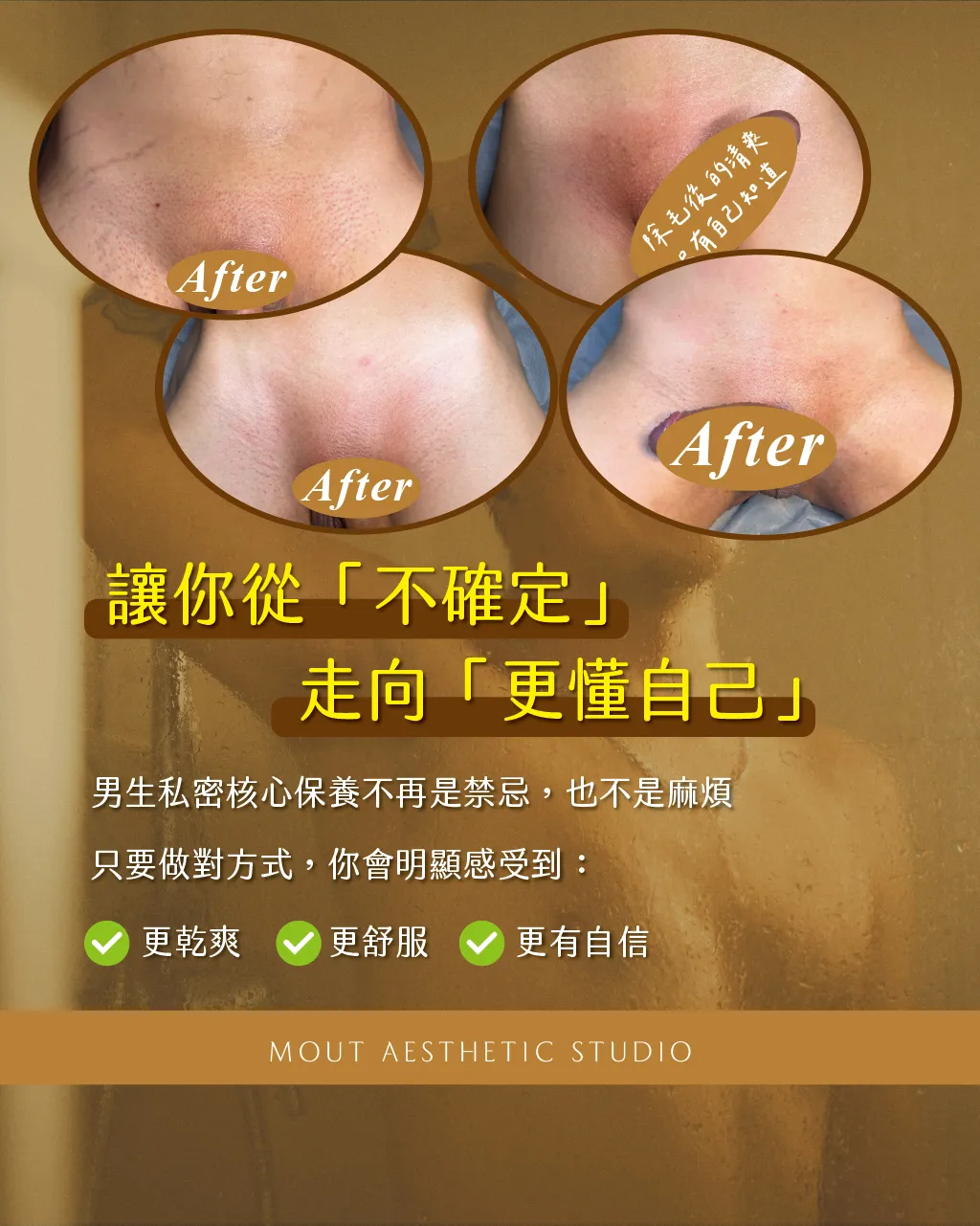 男士私密核心功能該如何保養？