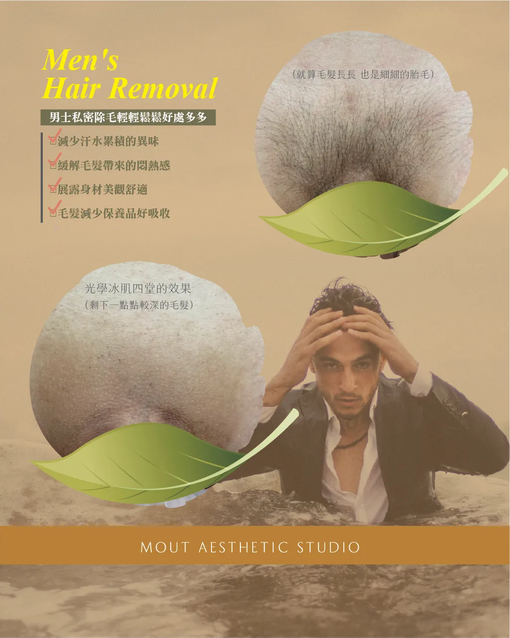 醫美雷射除毛 vs 日式光學冰肌除毛 有什麼不同？✨