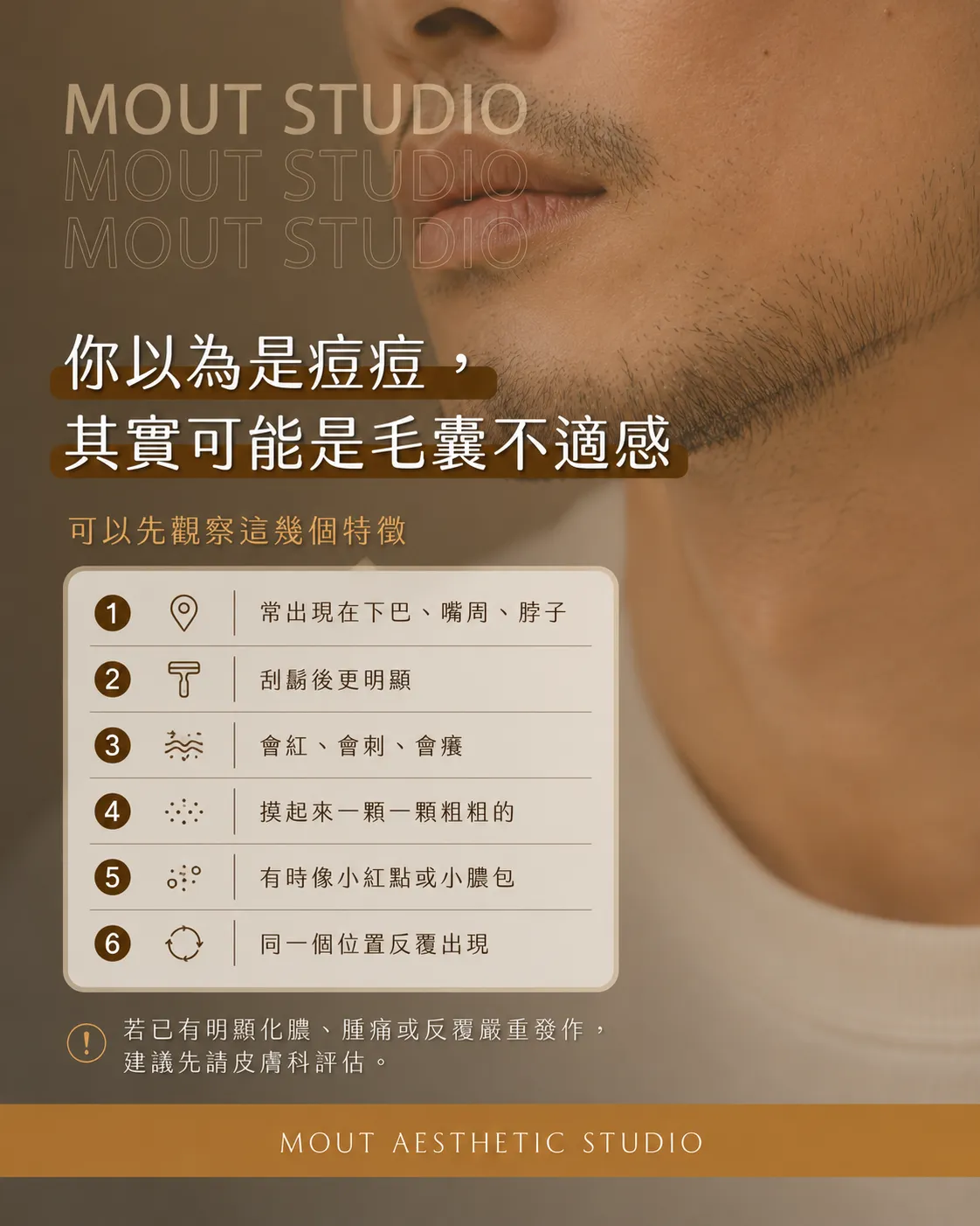 你以為是痘痘，其實可能是鬍子在鬧脾氣