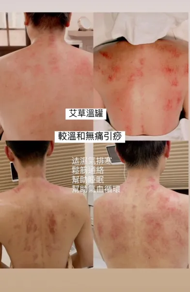 艾草溫罐