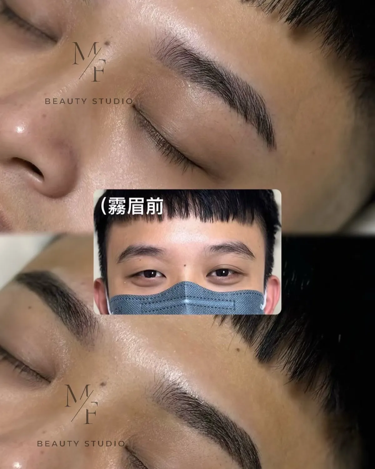 美容案例