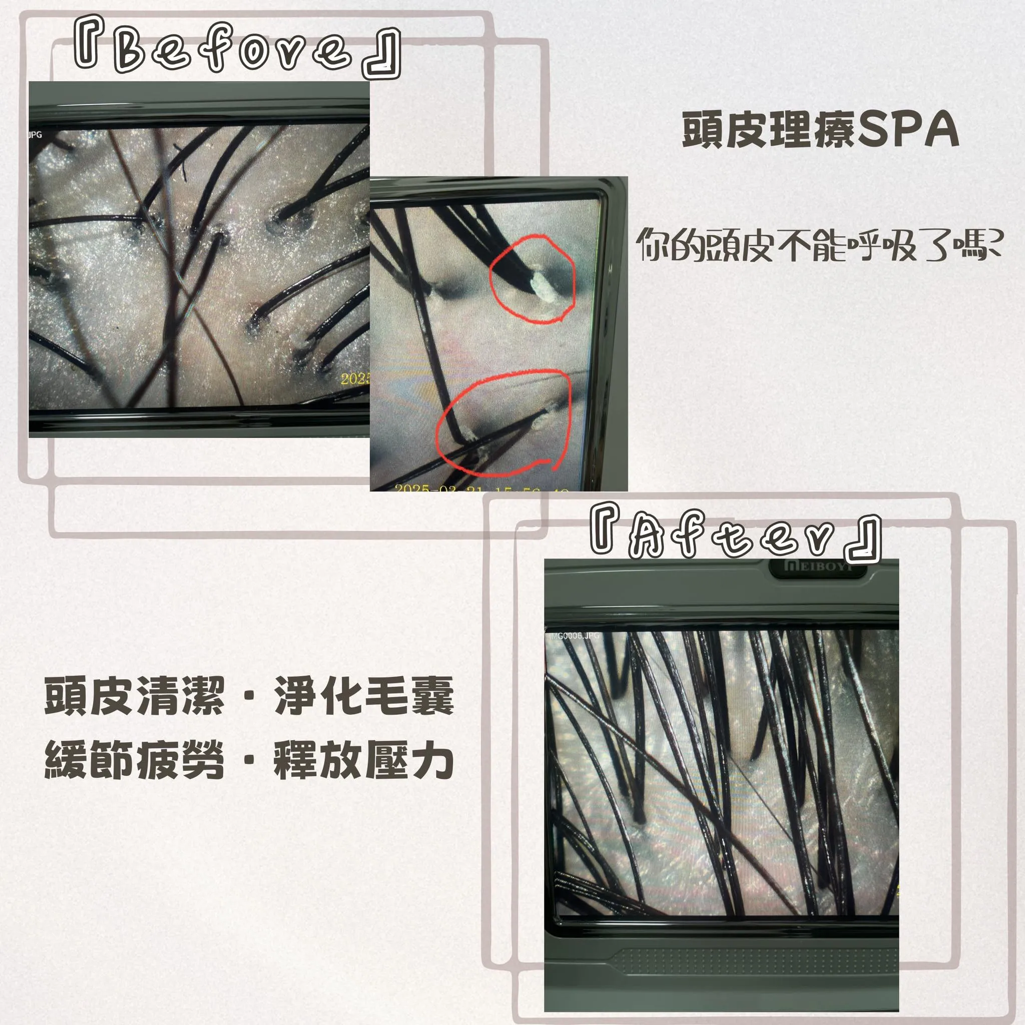 你的頭皮，也想好好呼吸嗎？