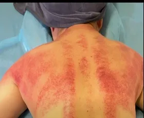 夏天太悶熱？用一場舒壓背部放鬆，找回輕盈感！