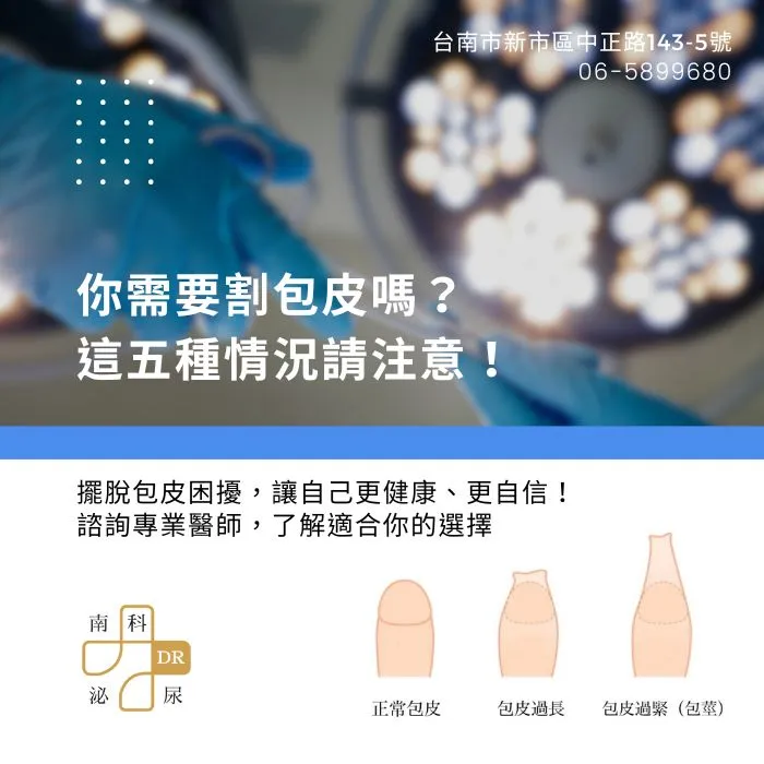 你需要割包皮嗎？這5種情況請注意！