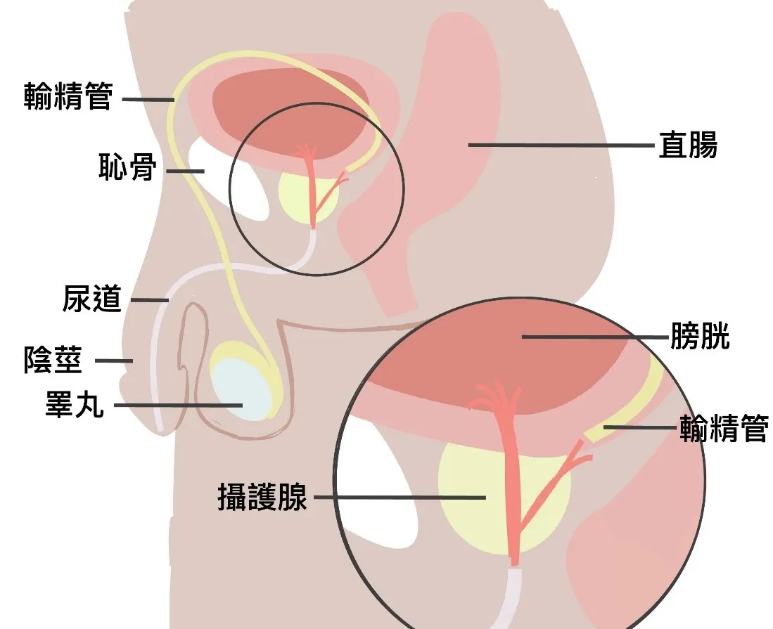 攝護腺肥大
