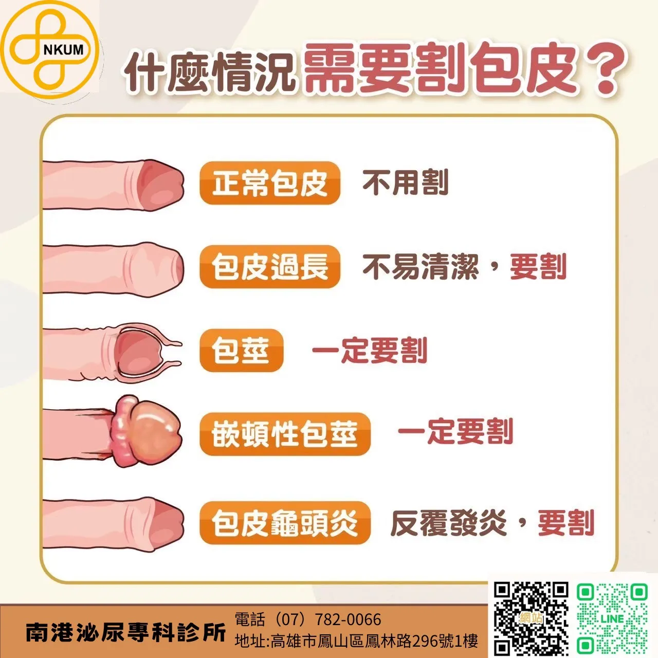 包皮手術大解析 !