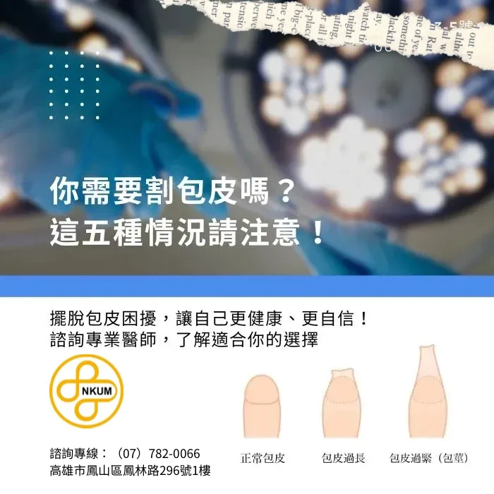 你需要割包皮嗎？這5種情況請注意！