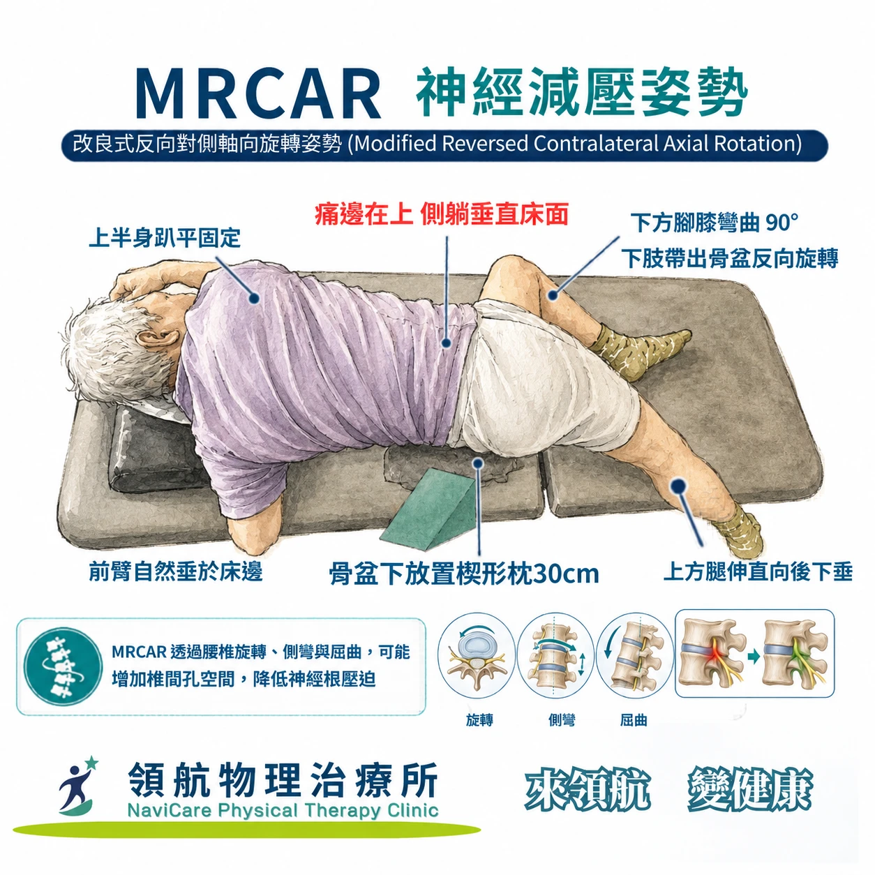 坐骨神經痛、腳麻一直不好？拉神經沒改善，可能是腰椎神經根壓迫｜領航物理治療所