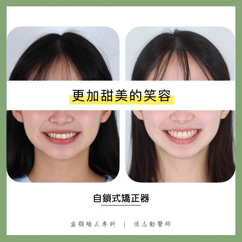 更加甜美的笑容