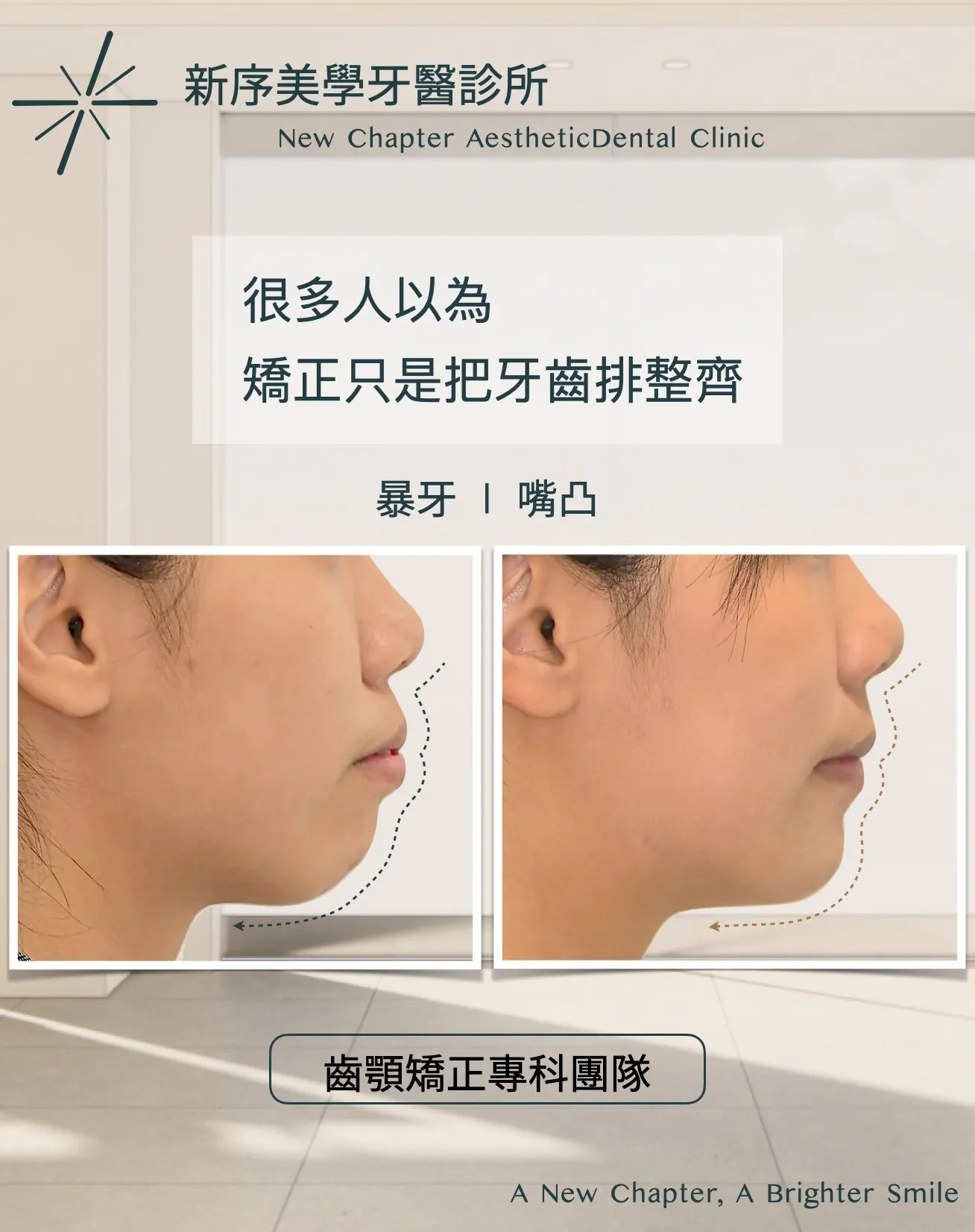 矯正，只是把牙齒排整齊嗎？