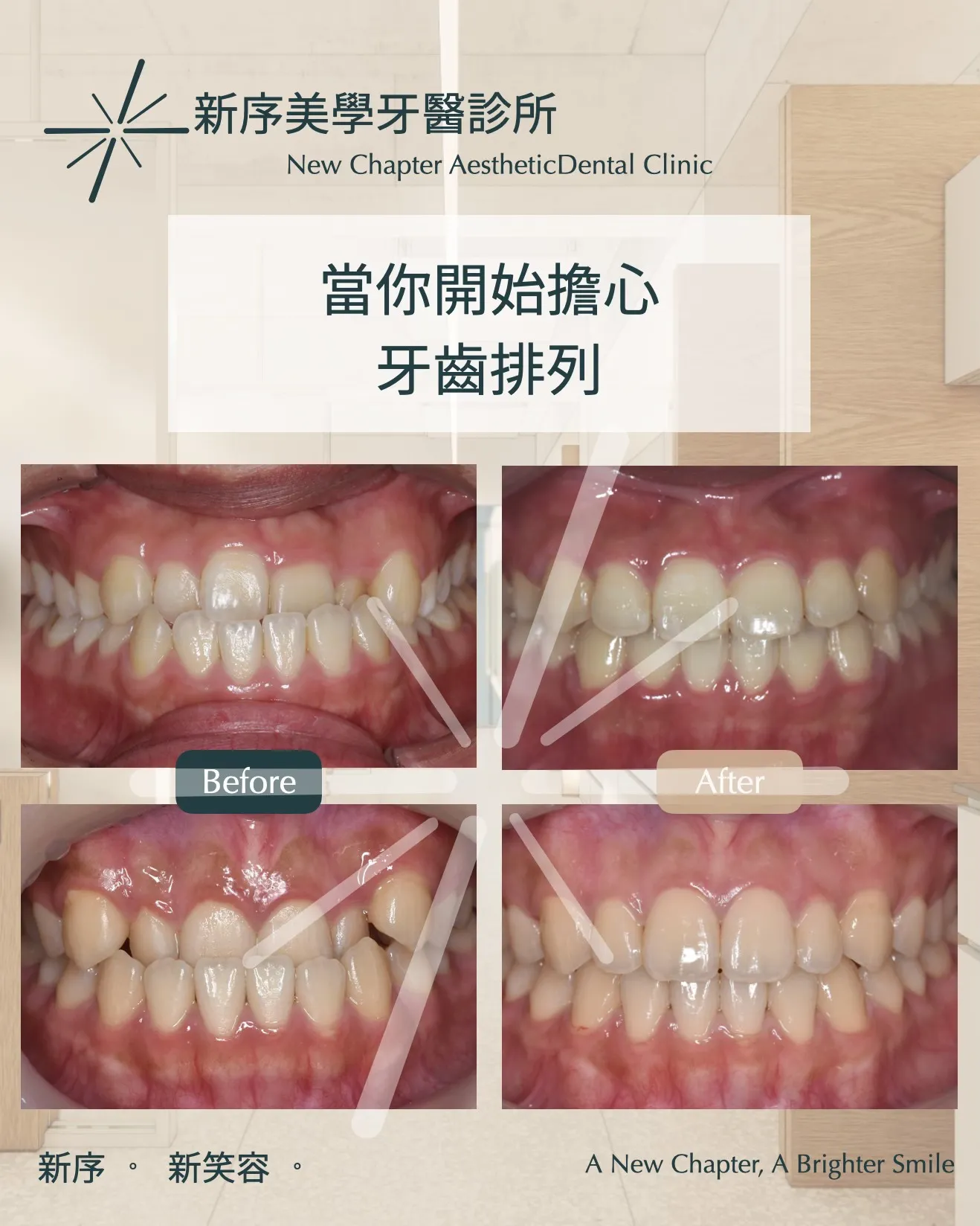 當你開始在意牙齒排列、臉型比例