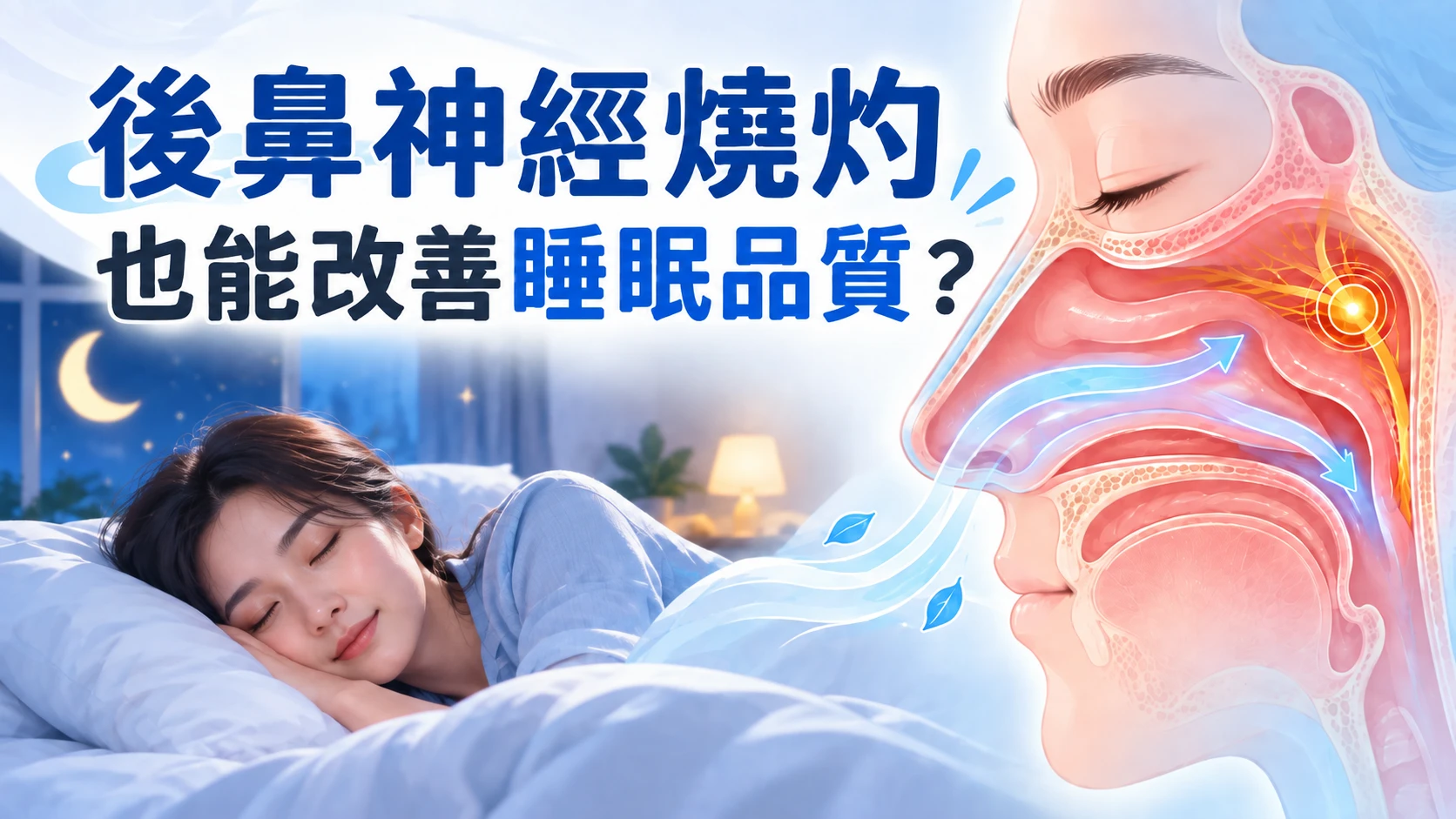 後鼻神經燒灼手術的安全關鍵：從血管位置到術後照護一次了解