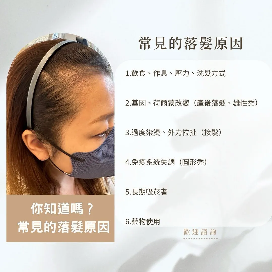 常見的落髮原因有哪些？/外泌體育髮/台中外泌體育髮