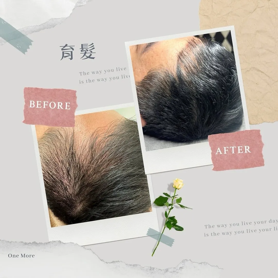 馬不是一天造成的 在育髮上也是如此
