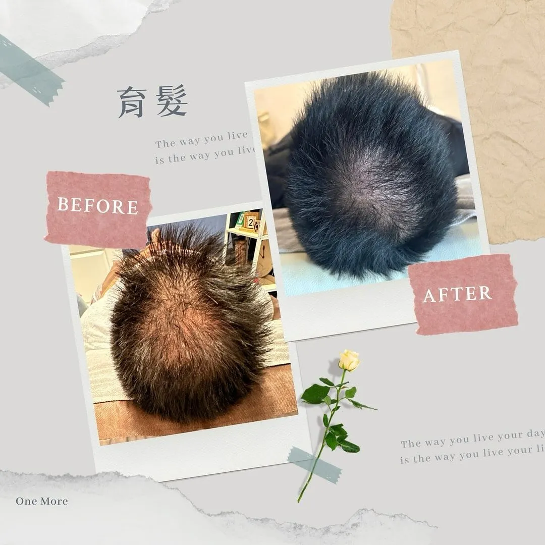育髮原理