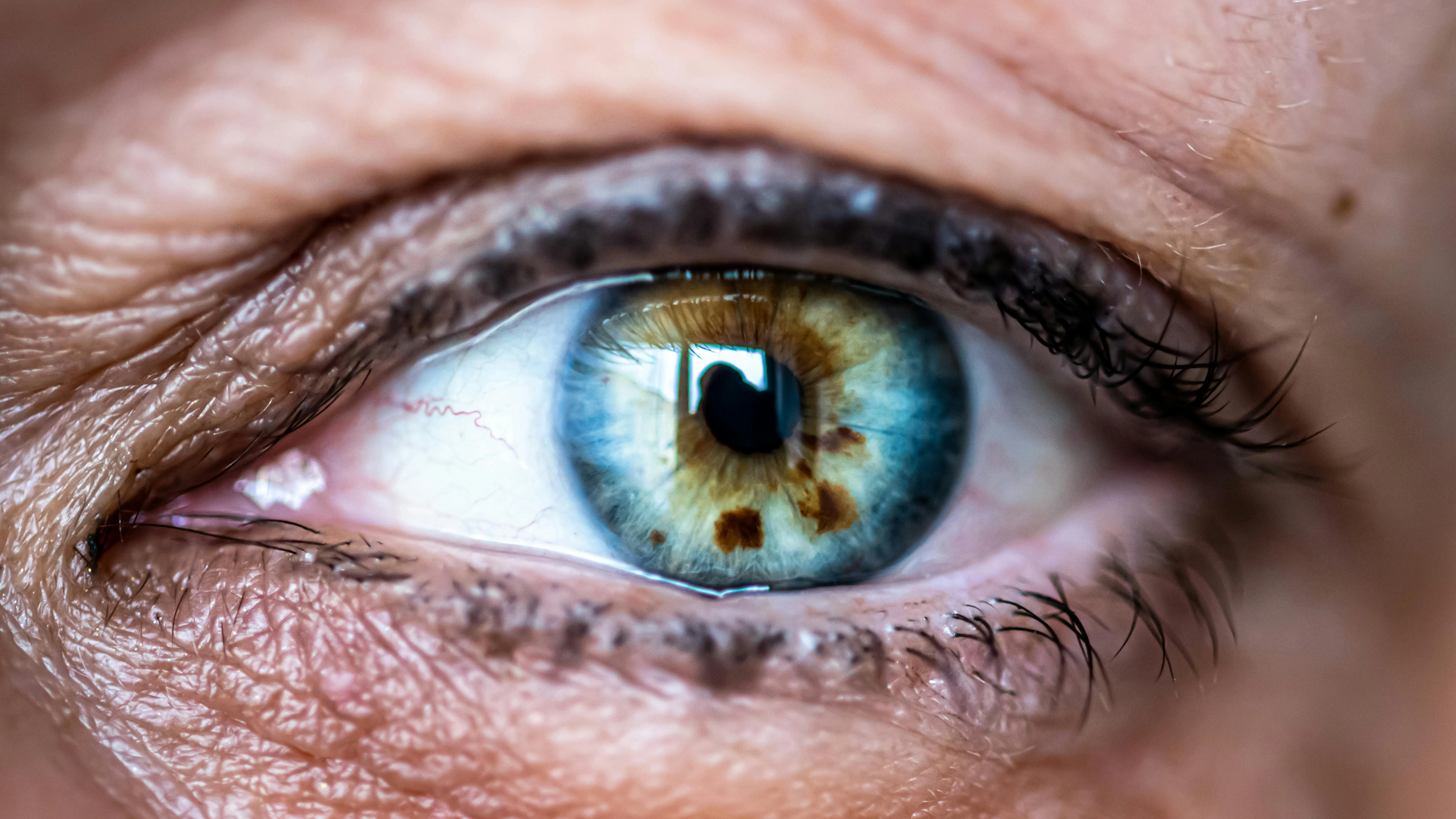 乾眼症與【植物硒】