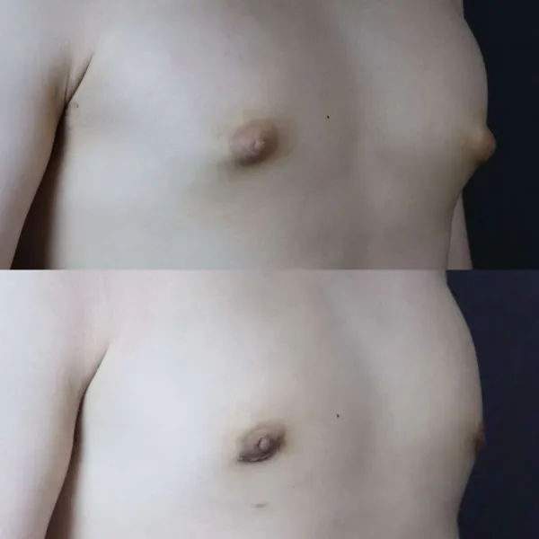 乳頭的形狀凸起且像女生，其實這是因為乳頭後面有乳腺所造成。