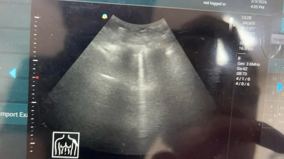 週二診間集 陳昱峰醫師