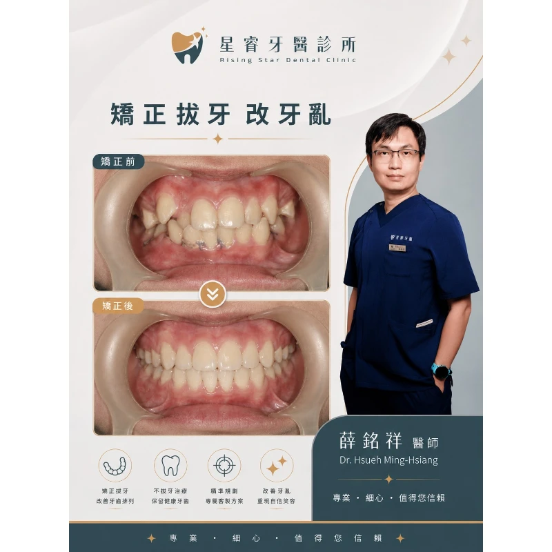 矯正拔牙 改牙亂