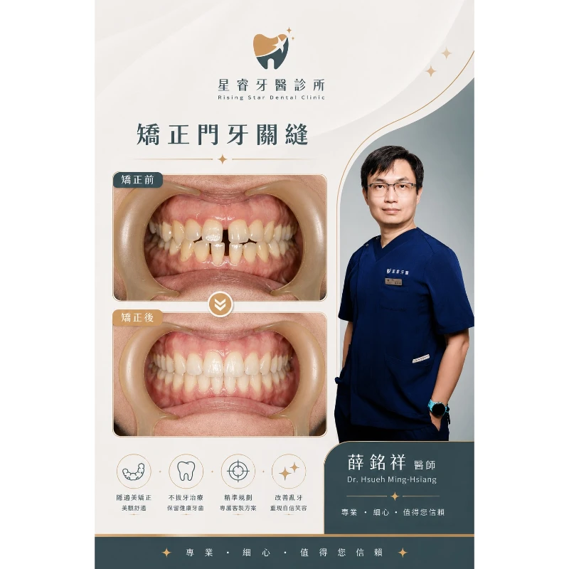 矯正門牙關縫