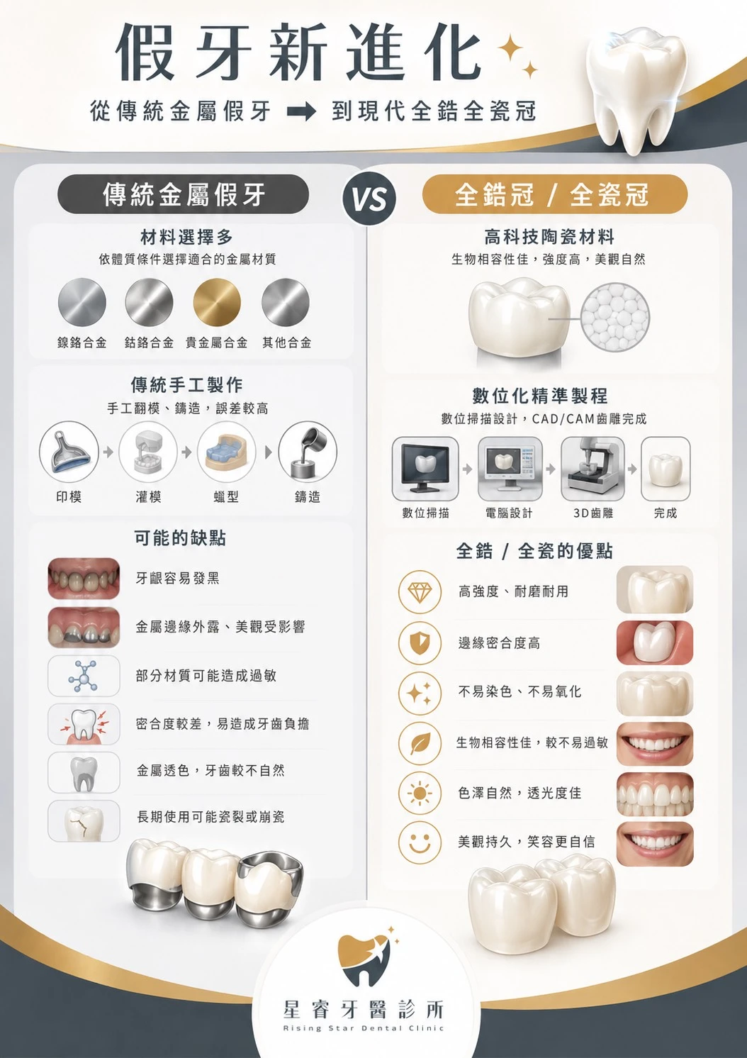 全瓷冠-最佳美學方案