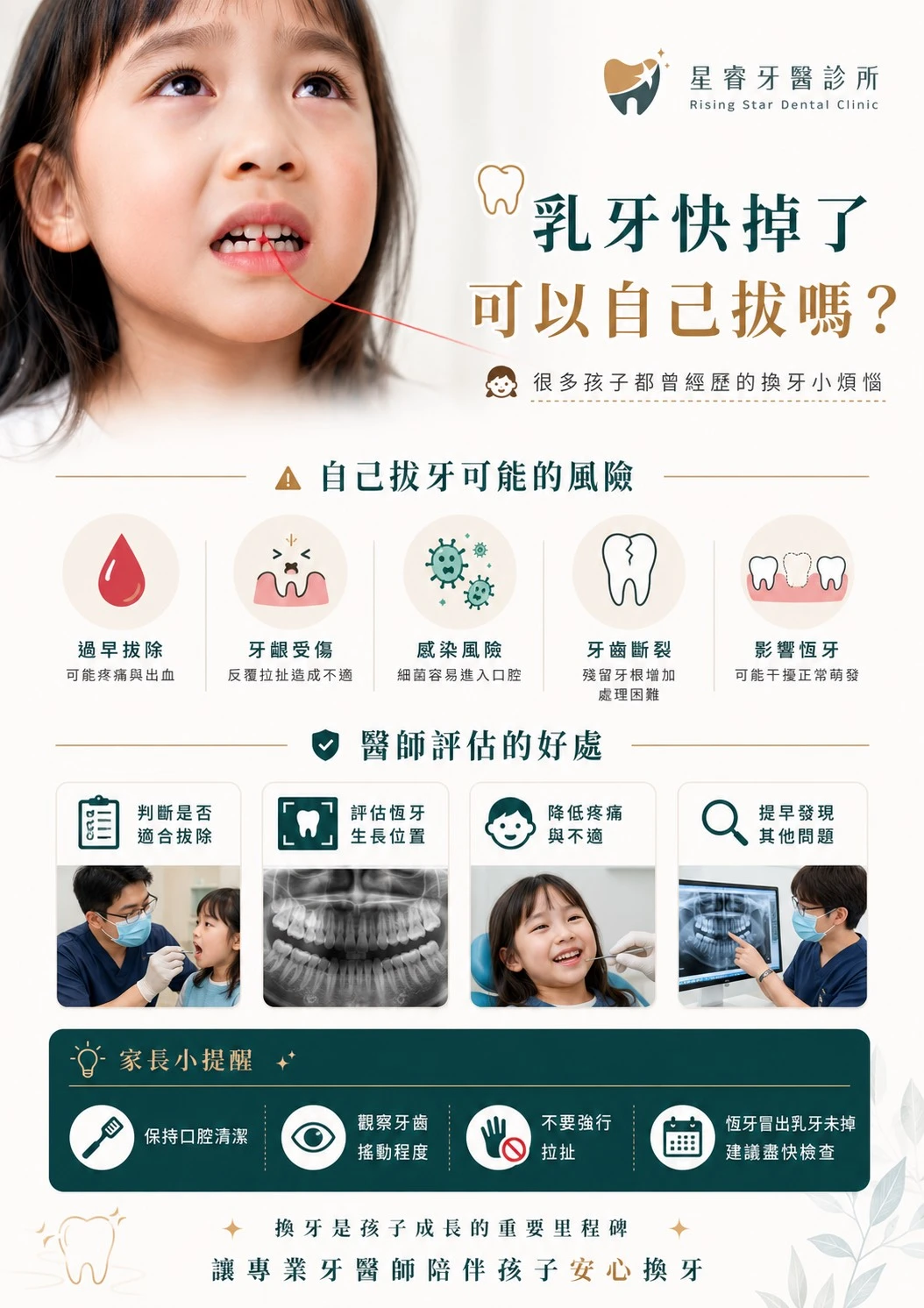 乳牙快掉了，可以自己拔嗎？
