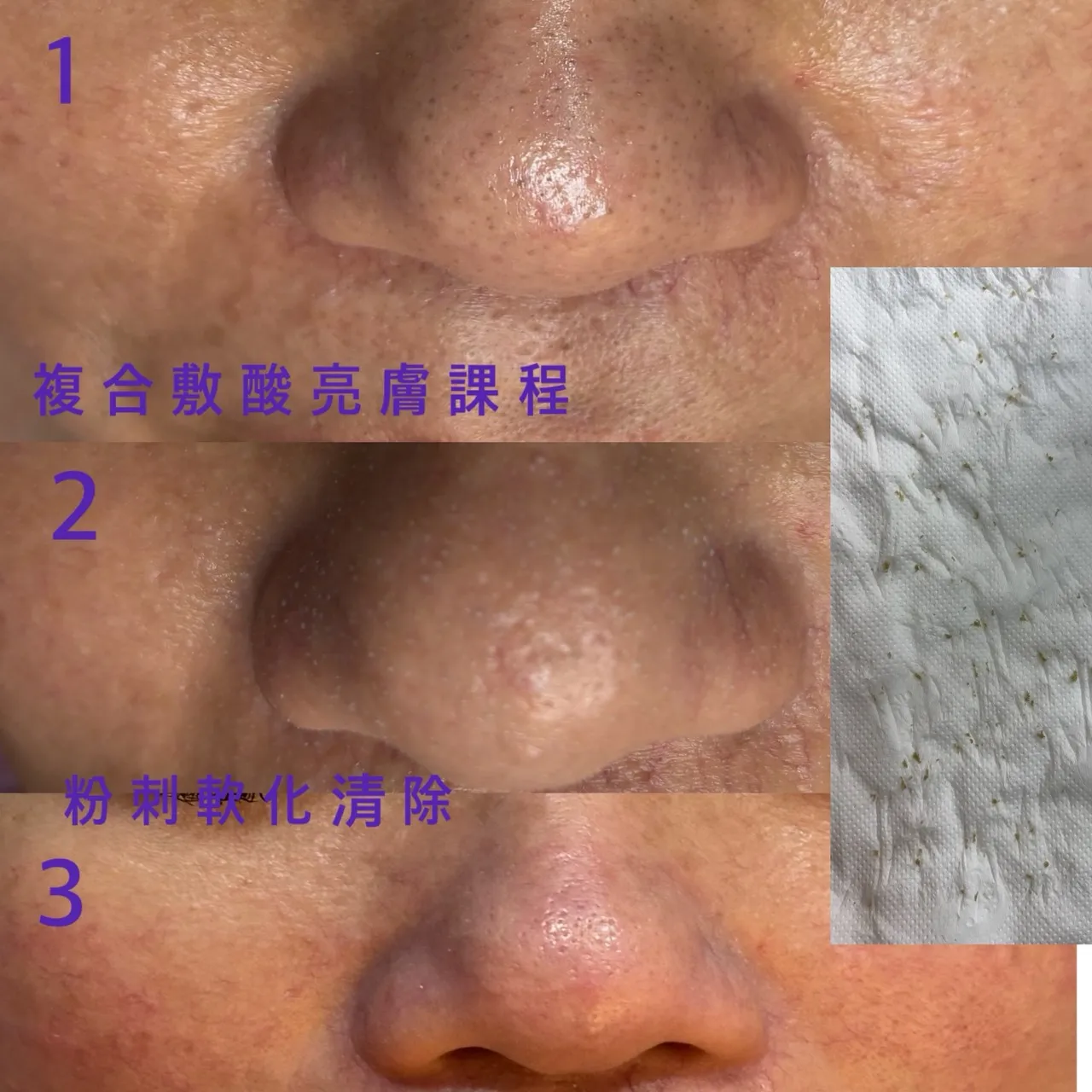 深耕複合果酸課程