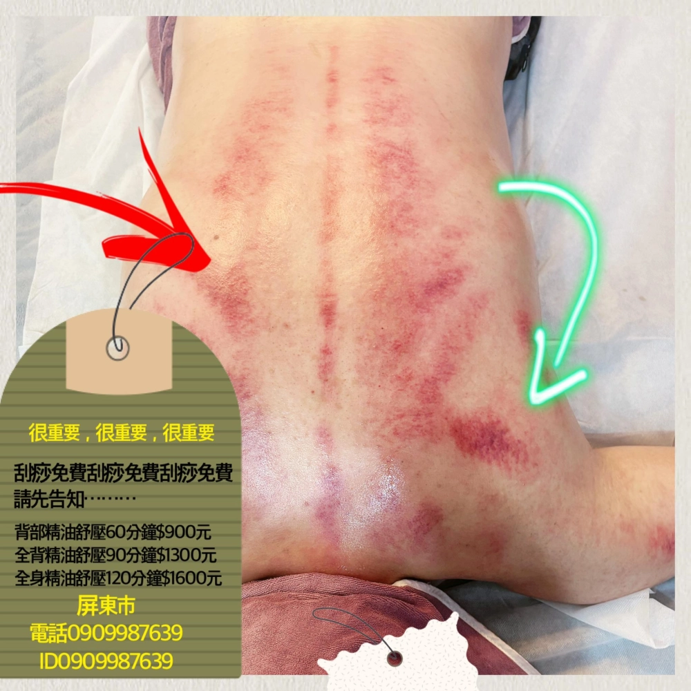 身體經絡＋刮痧保養