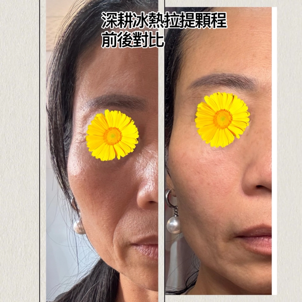 深耕冰熱拉提課程
