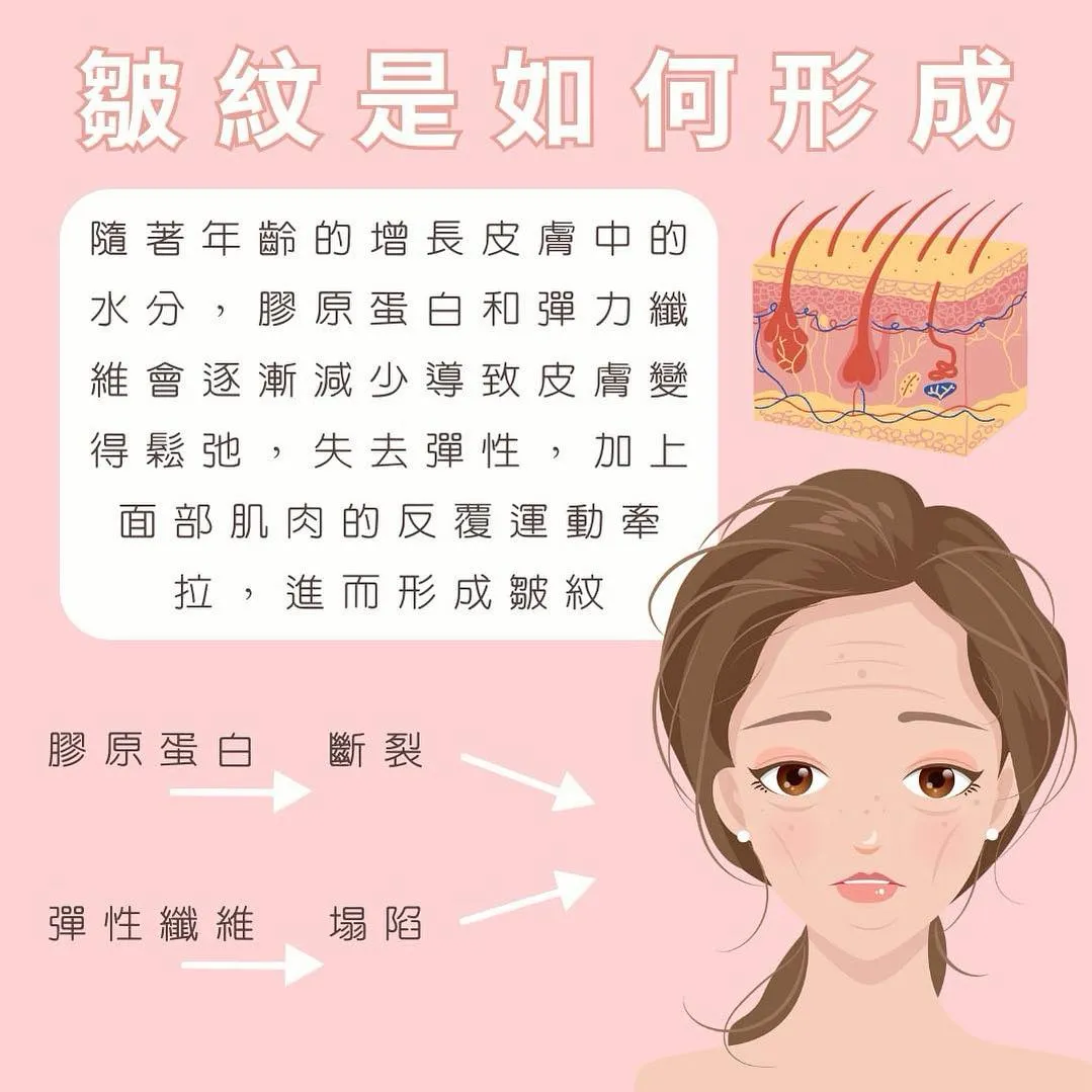 皺紋是如何形成？