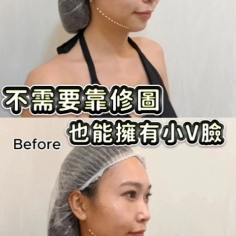 不需要靠修圖 也能擁有小V臉