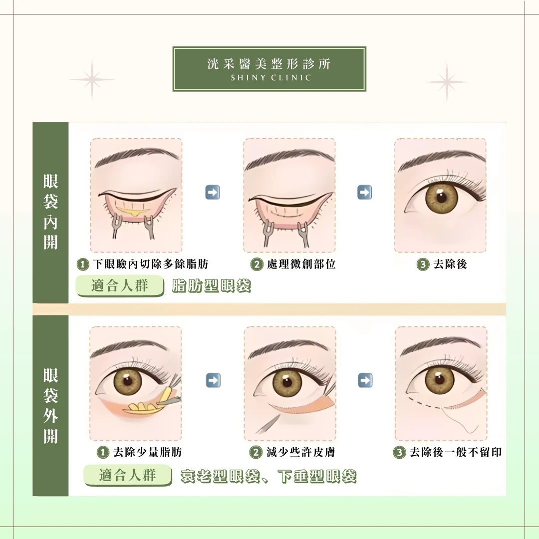 眼袋