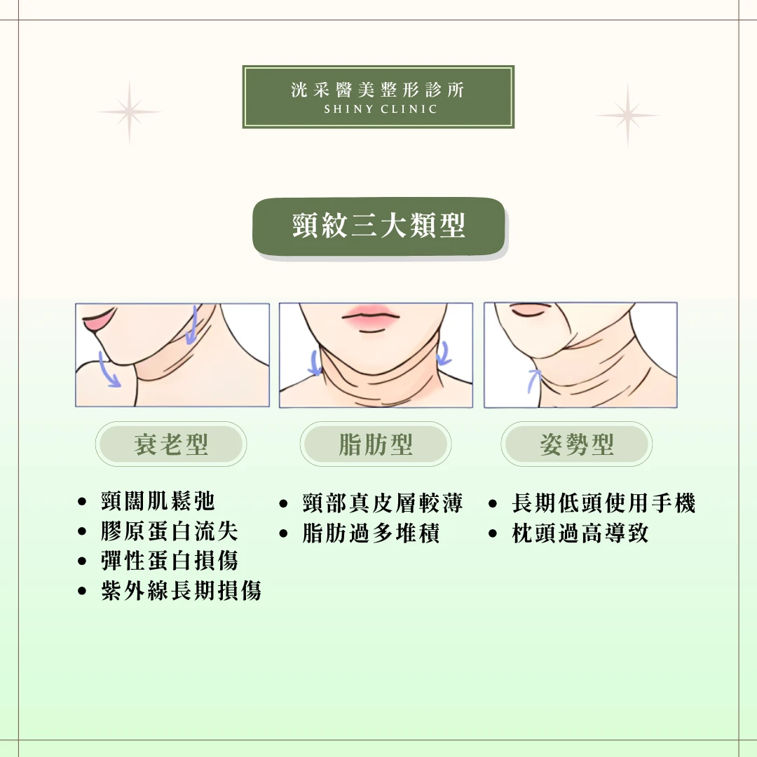天鵝頸