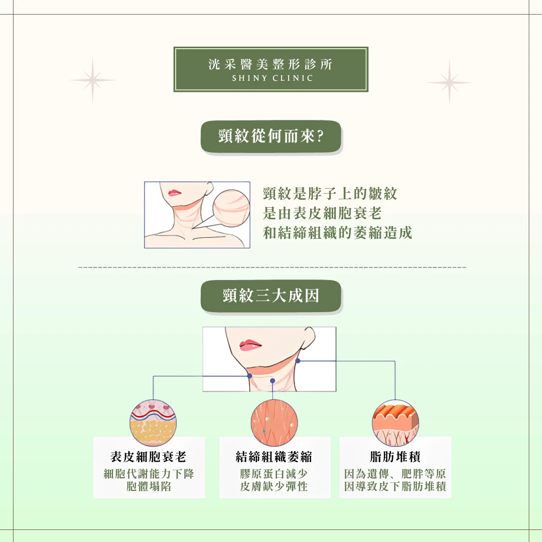 天鵝頸