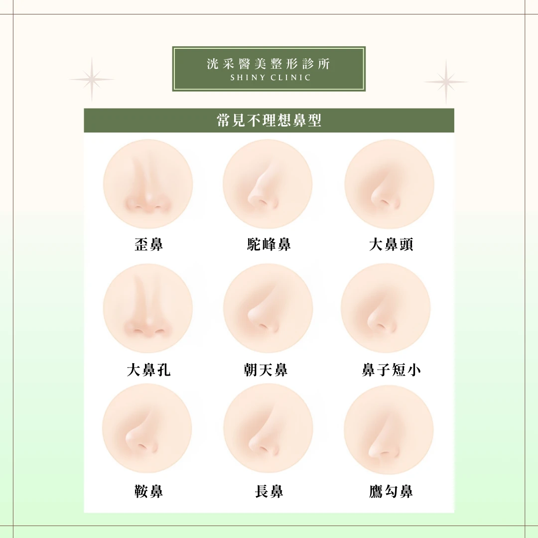 自體軟骨隆鼻
