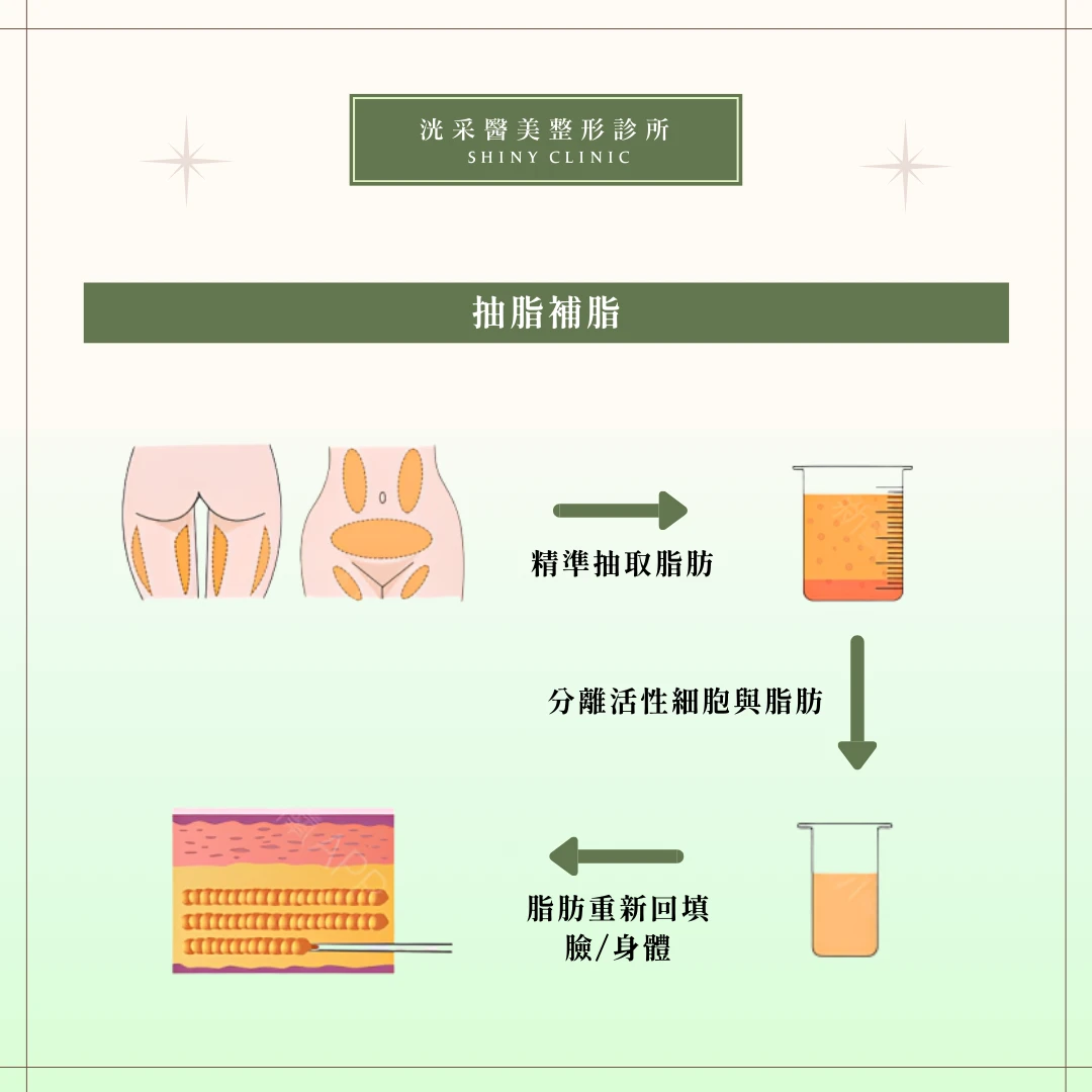 自體脂肪補脂