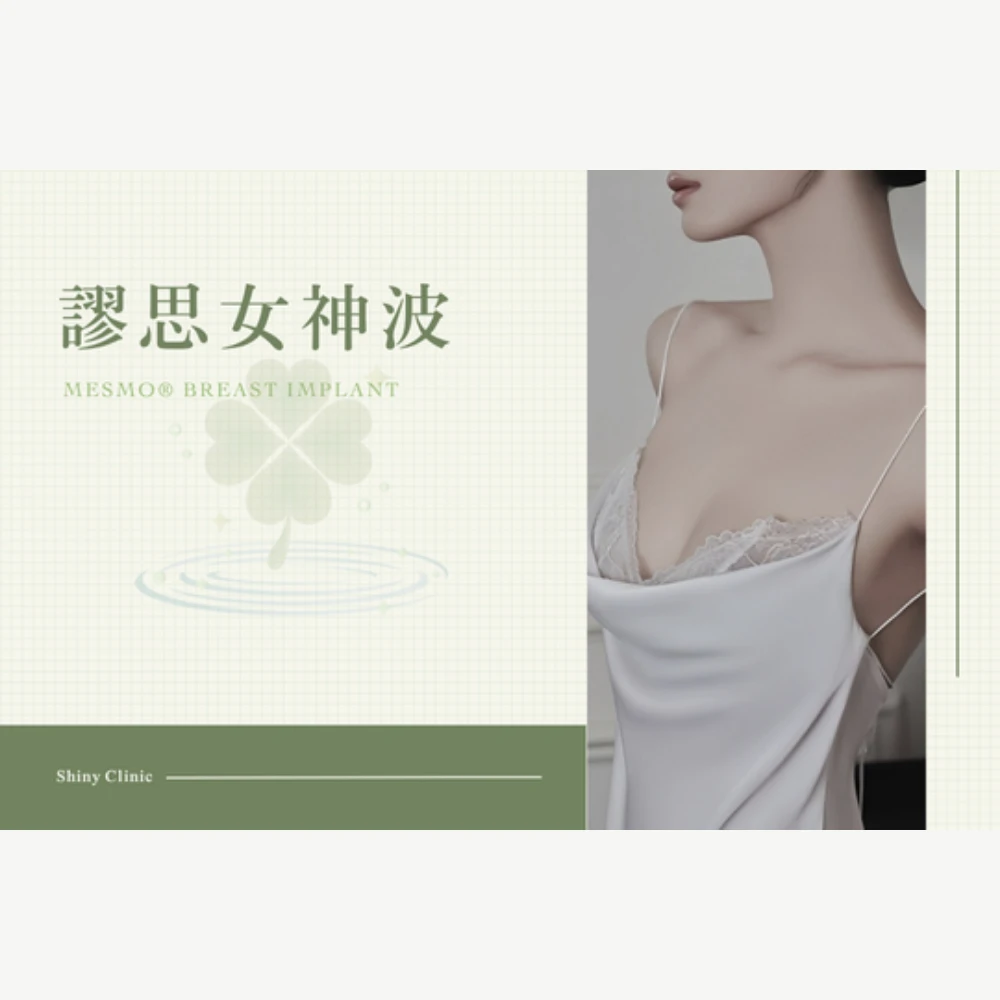 謬思女神波