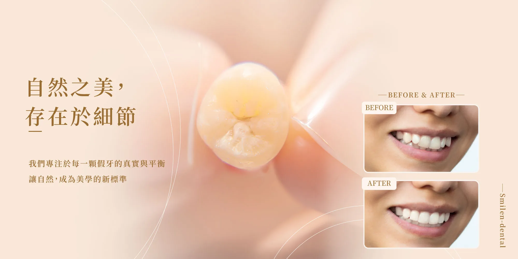 微笑林牙體技術所