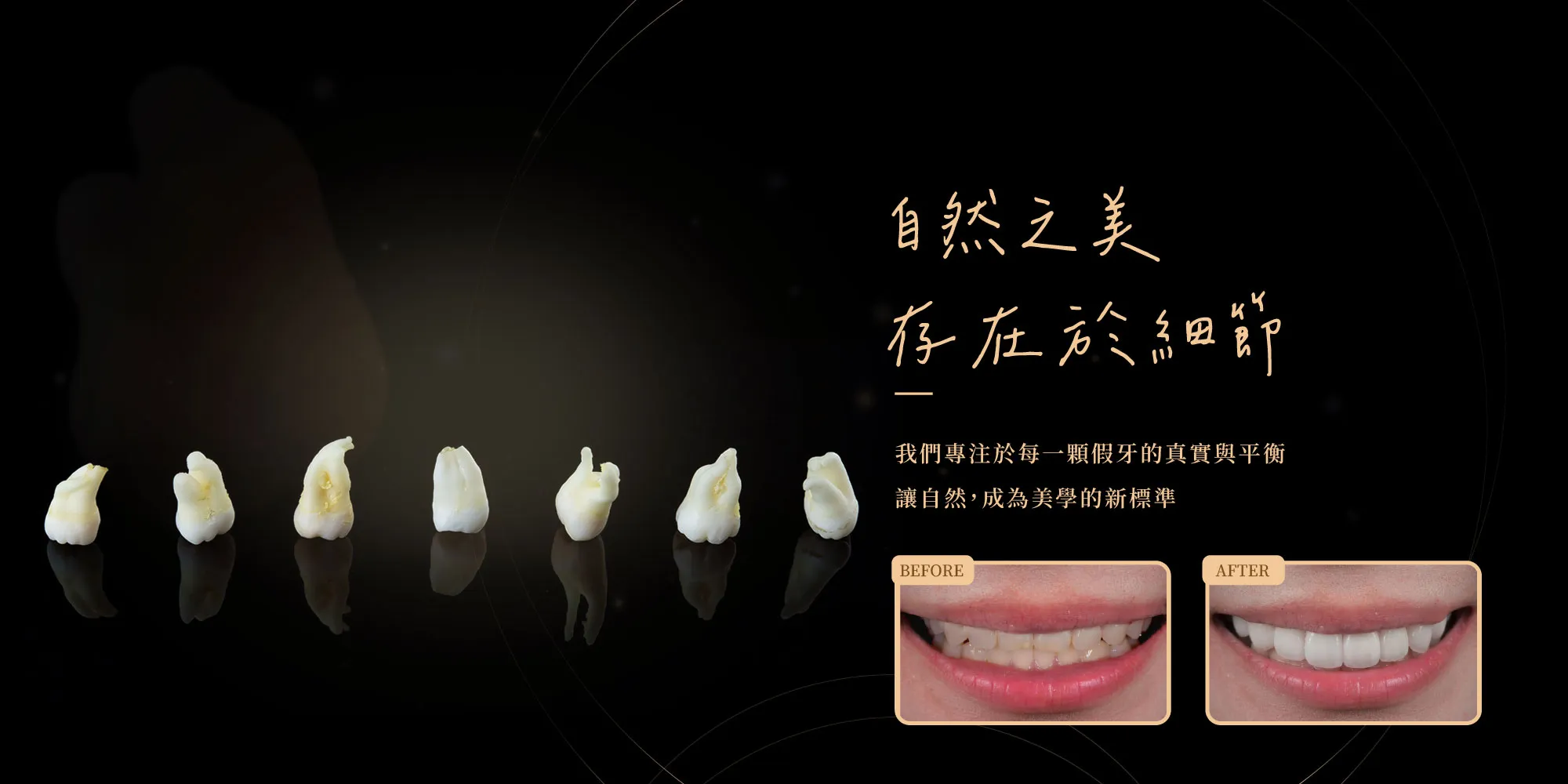 微笑林牙體技術所｜數位牙技所, 微笑曲線設計,台中牙技所,南區牙技所