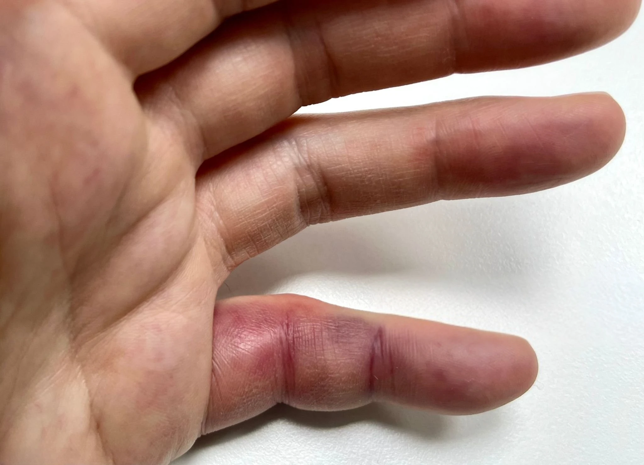 手指吃蘿蔔是什麼意思？常見狀況一次看懂