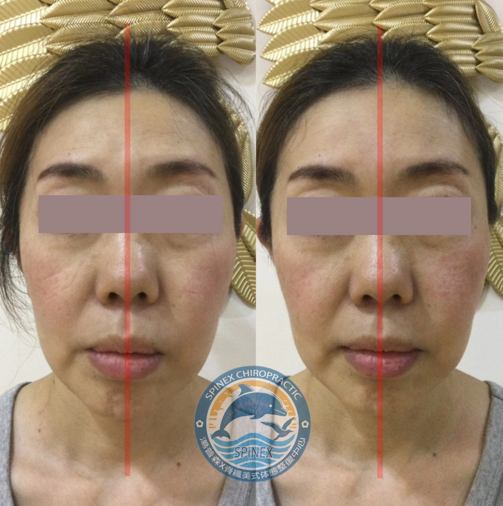 臉部均衡調理
